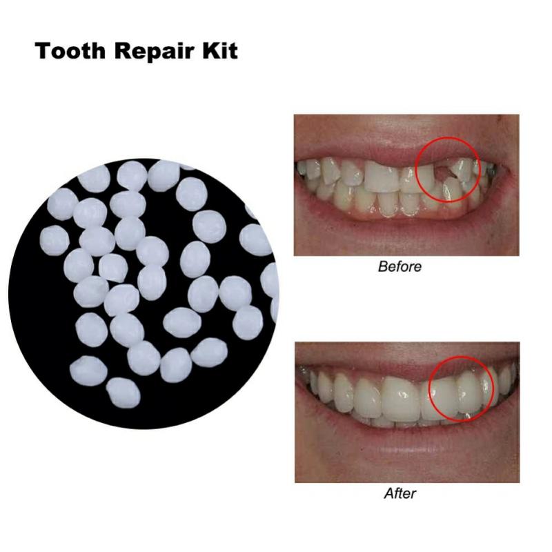 正品！美國進口樹脂材料補牙 DIY補牙 自製假牙  臨時假牙 化妝補牙 自製假牙套 牙齒修補材料