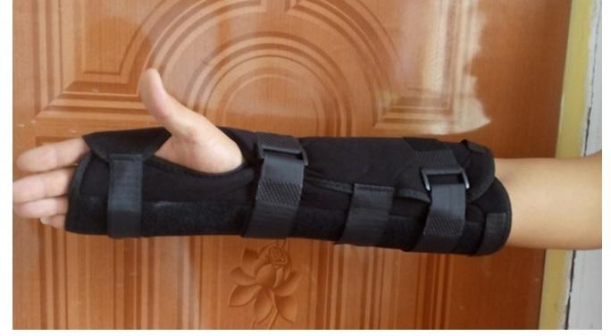 加強前臂支具 關節 前臂橈骨固定 小臂骨折 手腕骨折 外固定支具