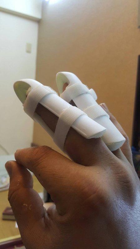 護指醫用護指 護手 護指 手指 骨折 康復 手指套 伸直手指 復健 手指套 末節指 固定器 伸直 手指 固定 矯正器