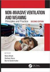 Non-Invasive Ventilation and Weaning, Prinicples and Prac