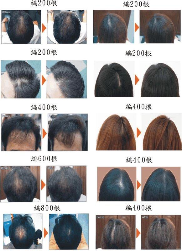 編髮~可重複使用的歐 <<<<全台灣只有這裡有。 稀疏頭髮的福音，日本新技術，附著式纖維 假髮，髮線及頂上稀疏的救星
