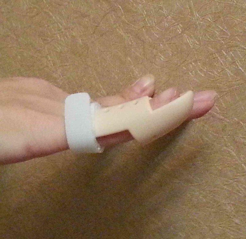 護指 護手 護指 手指 骨折 康復 手指套 伸直手指 復健 手指套 末節指 固定器 伸直 手指 固定 矯正器