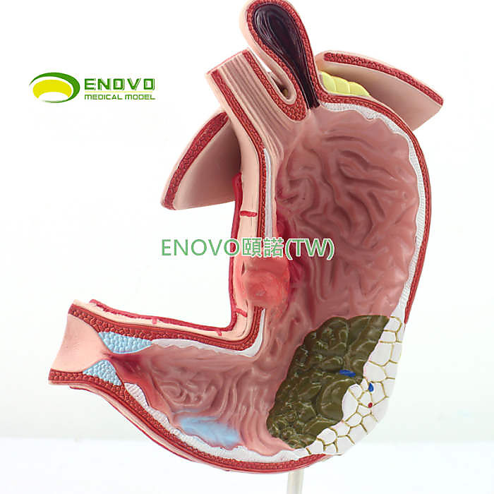 (ENOVO-319) 醫學胃部疾病演示模型人體胃解剖消化系統模型消化科 